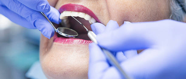 Best Emergency Tooth Extraction in Washington Court House, OH
